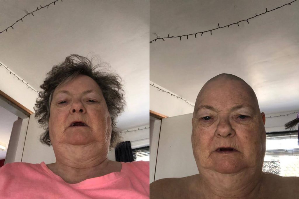 A before and after photo of a woman with shaved head